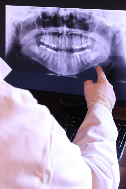 Best Emergency Dental Extractions in Lyons, IL