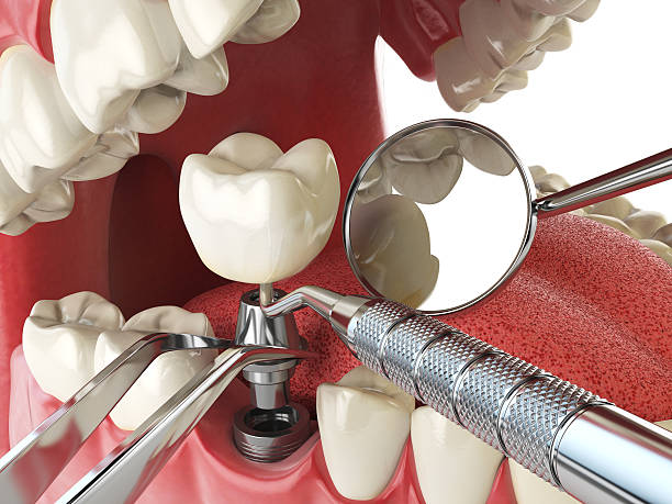Best Emergency Dentist for Knocked-Out Tooth in Lyons, IL